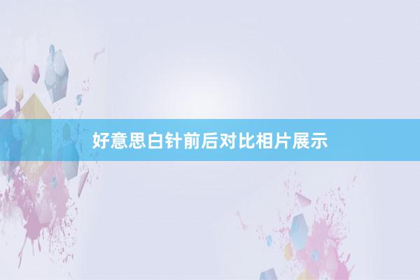 好意思白针前后对比相片展示